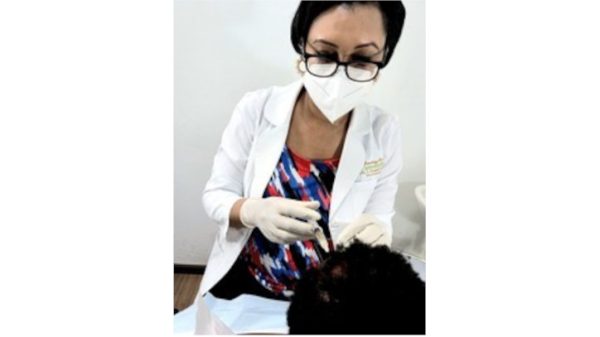 Prp - Scalp