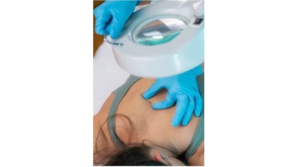 Cautery/Cryotherapy - Partial Arms Or Partial Back Or Buttocks Or Abdomen