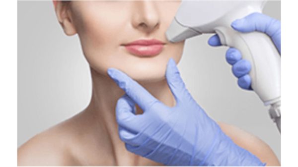 Laser Hair Removal - Full Beard And Upper Lip