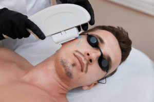 Man receiving laser hair removal treatment