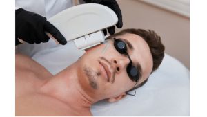 Laser Hair Removal - Partial Beard Or Underarms Or Toes