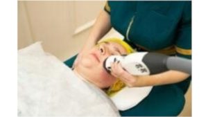 Laser Skin Treatments - Face And Neck