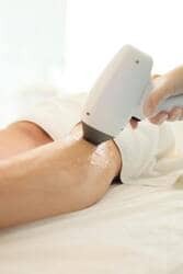 Laser hair removal legs